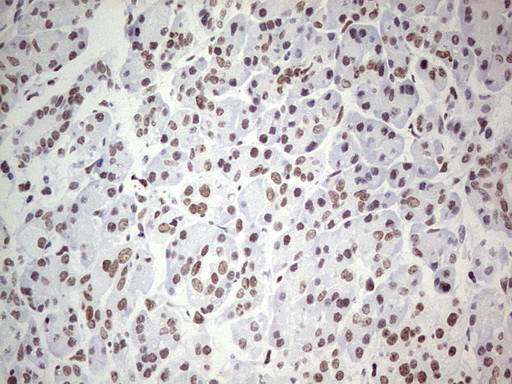 PPP1R8 Antibody in Immunohistochemistry (Paraffin) (IHC (P))