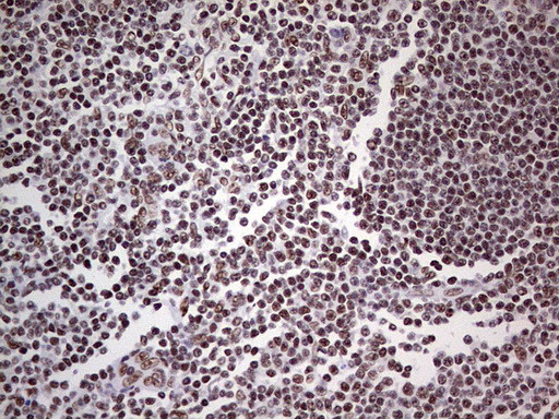 PPP1R8 Antibody in Immunohistochemistry (Paraffin) (IHC (P))