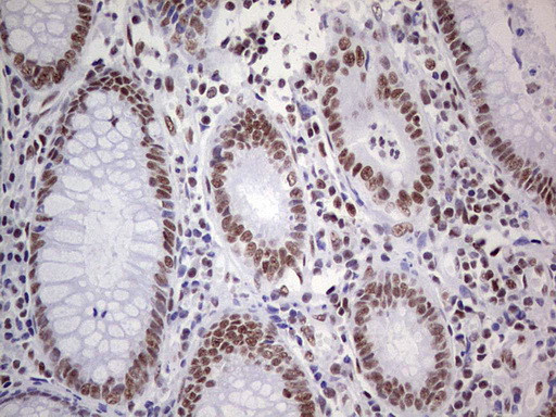 PPP1R8 Antibody in Immunohistochemistry (Paraffin) (IHC (P))