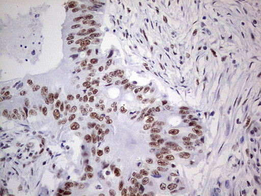 PPP1R8 Antibody in Immunohistochemistry (Paraffin) (IHC (P))