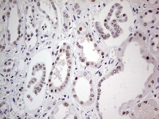 PPP1R8 Antibody in Immunohistochemistry (Paraffin) (IHC (P))