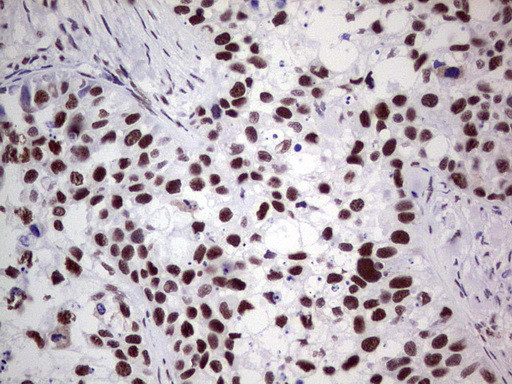 PPP1R8 Antibody in Immunohistochemistry (Paraffin) (IHC (P))