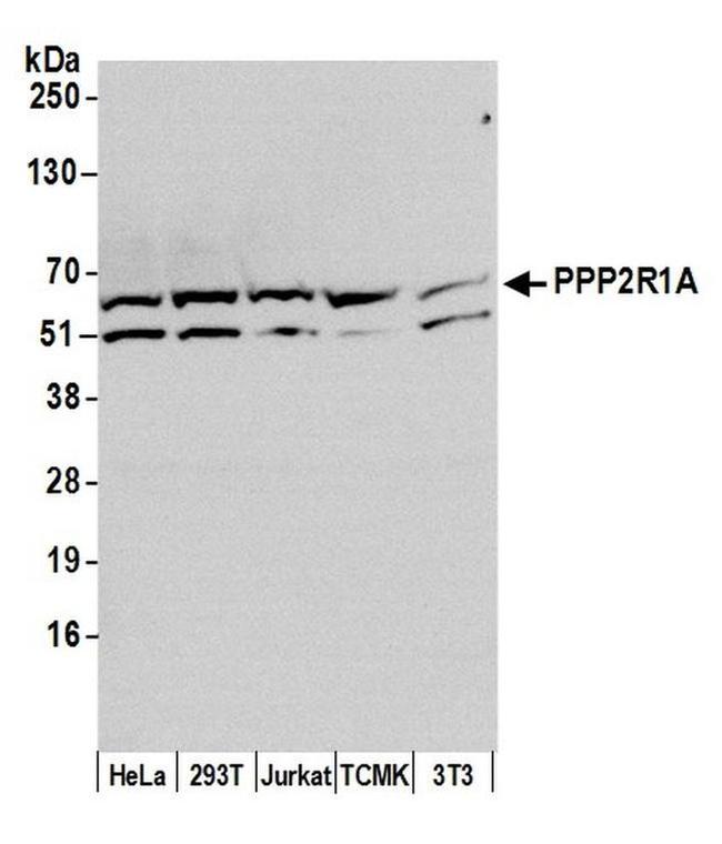 PPP2R1A Antibody in Western Blot (WB)