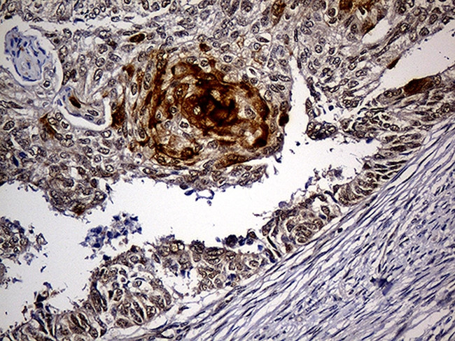 PPP2R1B Antibody in Immunohistochemistry (Paraffin) (IHC (P))