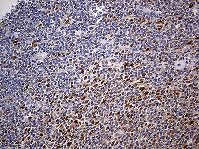 PPP2R1B Antibody in Immunohistochemistry (Paraffin) (IHC (P))