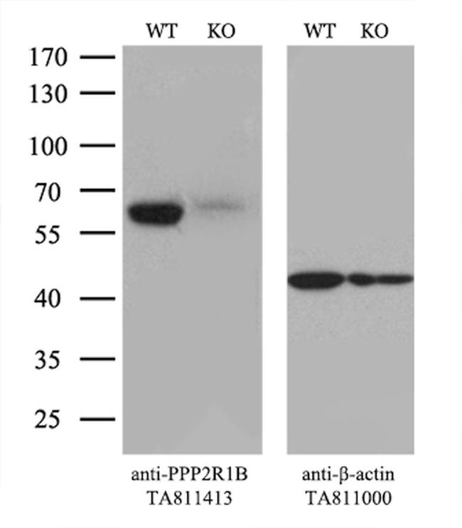 PPP2R1B Antibody in Western Blot (WB)