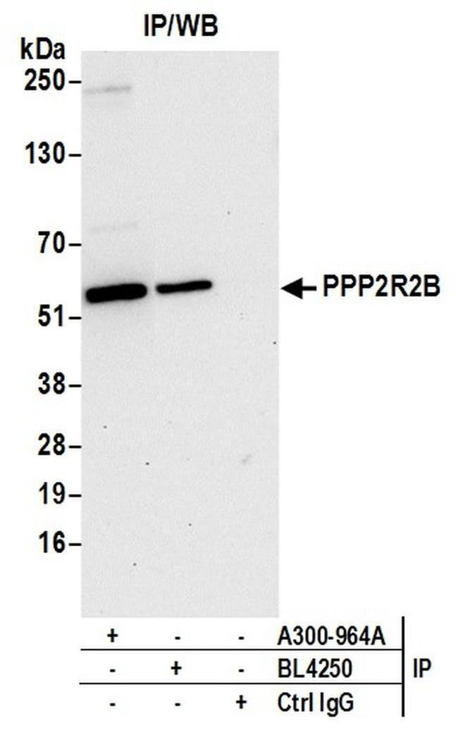 PPP2R2B Antibody in Western Blot (WB)