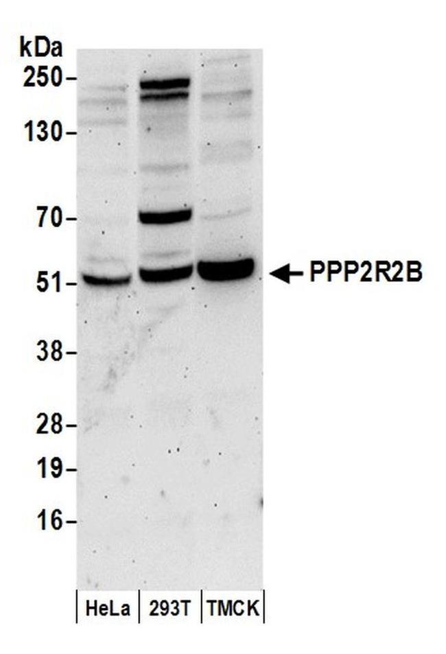 PPP2R2B Antibody in Western Blot (WB)