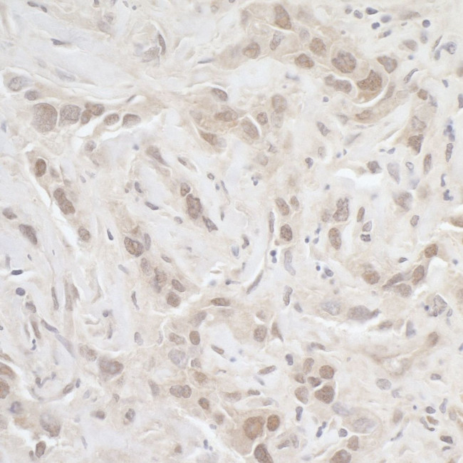 PPP3CA Antibody in Immunohistochemistry (IHC)