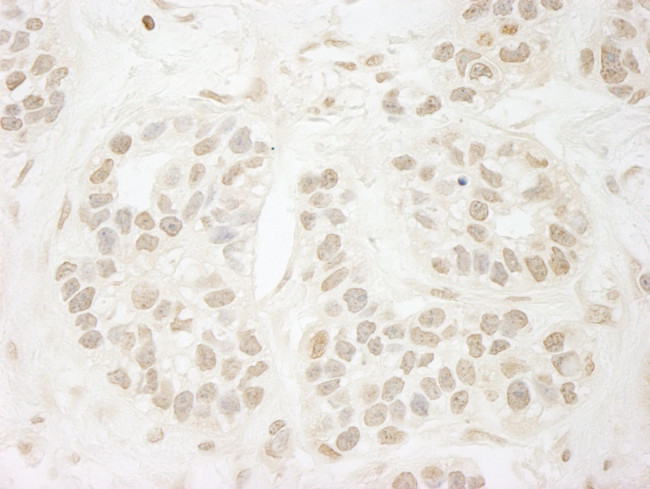 PPP3CA Antibody in Immunohistochemistry (IHC)