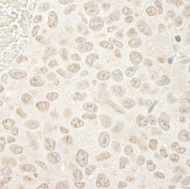 PPP3CA Antibody in Immunohistochemistry (IHC)