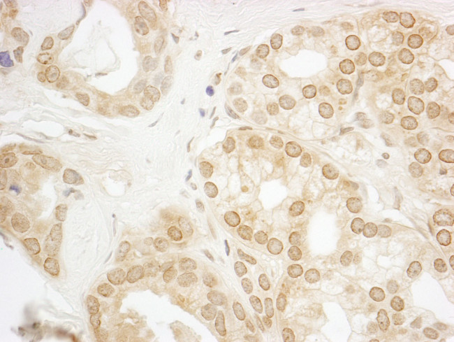 PPP3CA Antibody in Immunohistochemistry (IHC)