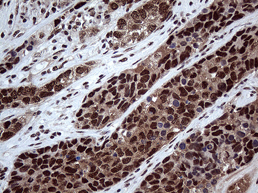 PPP4C Antibody in Immunohistochemistry (Paraffin) (IHC (P))