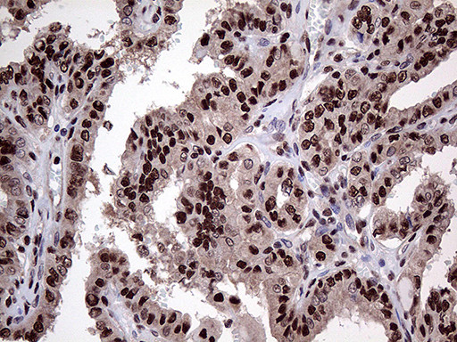 PPP4C Antibody in Immunohistochemistry (Paraffin) (IHC (P))