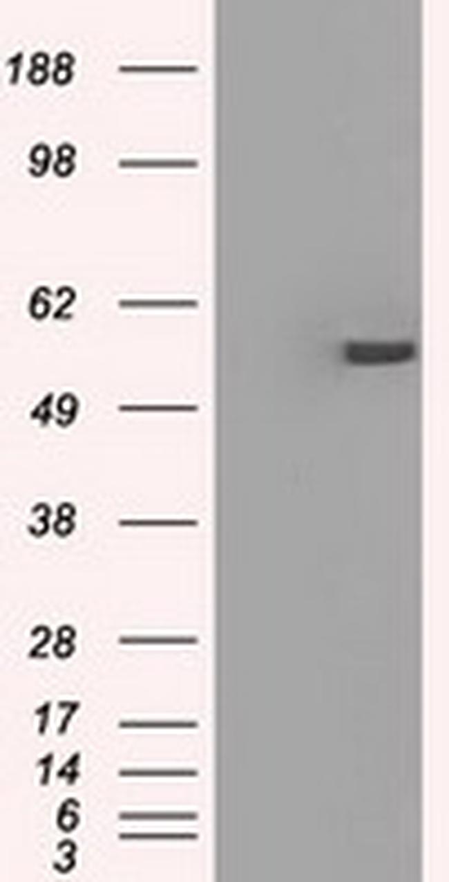 PPP5C Antibody in Western Blot (WB)