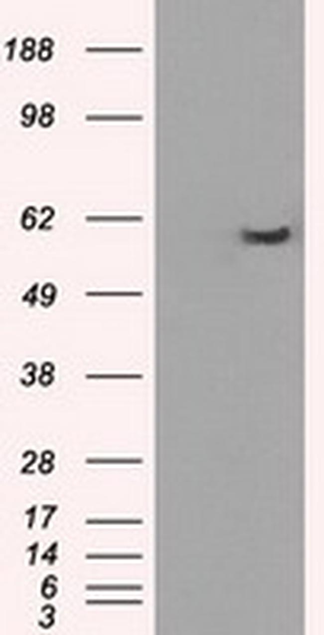 PPP5C Antibody in Western Blot (WB)