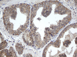 PPT1 Antibody in Immunohistochemistry (Paraffin) (IHC (P))