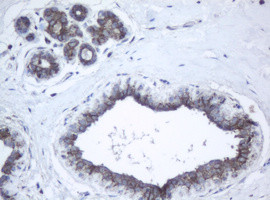 PPT1 Antibody in Immunohistochemistry (Paraffin) (IHC (P))