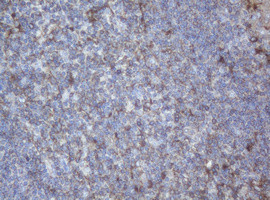 PPT1 Antibody in Immunohistochemistry (Paraffin) (IHC (P))