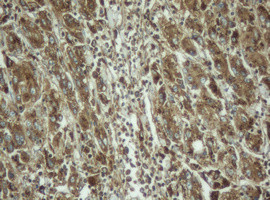 PPT1 Antibody in Immunohistochemistry (Paraffin) (IHC (P))