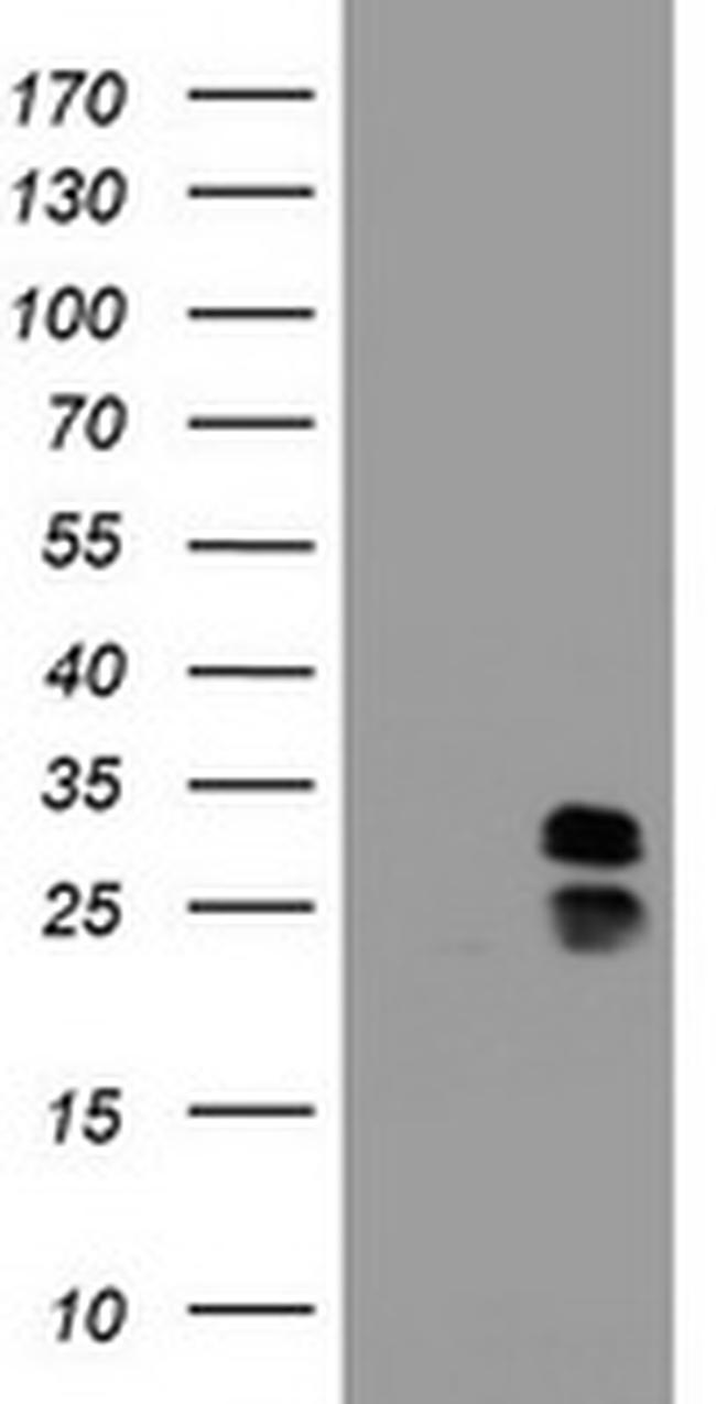 PPT1 Antibody in Western Blot (WB)