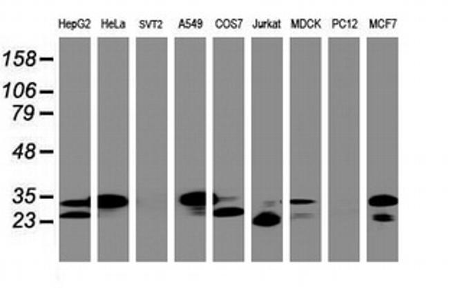 PPT1 Antibody in Western Blot (WB)