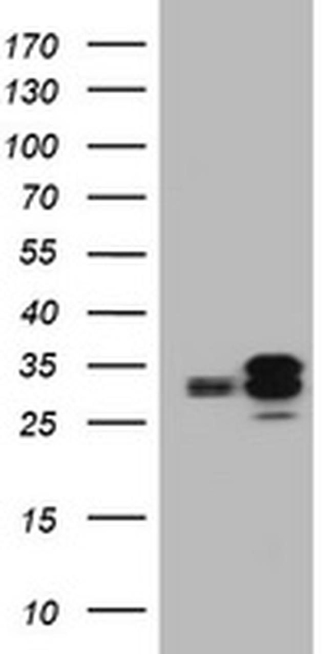 PPT1 Antibody in Western Blot (WB)