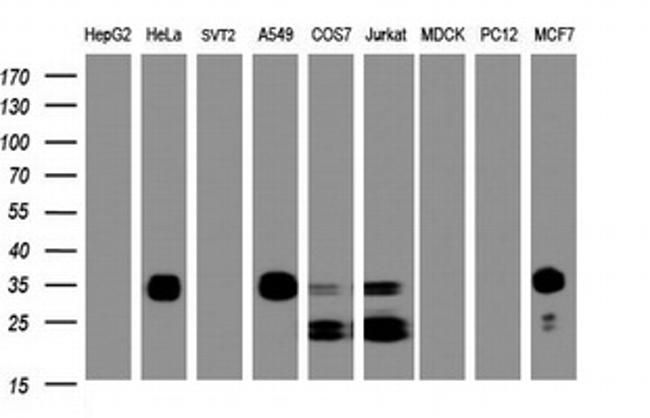 PPT1 Antibody in Western Blot (WB)