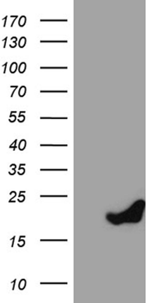 PRDX5 Antibody in Western Blot (WB)