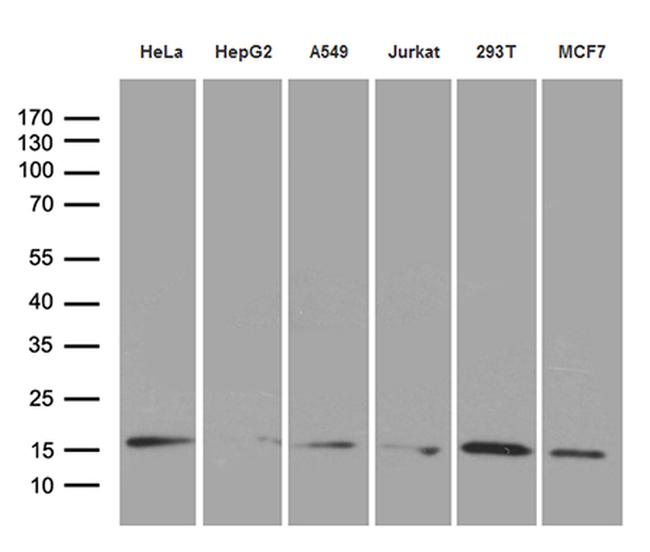 PRDX5 Antibody in Western Blot (WB)