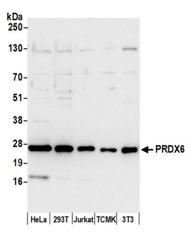 PRDX6 Antibody in Western Blot (WB)