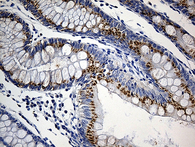 PRELID1 Antibody in Immunohistochemistry (Paraffin) (IHC (P))