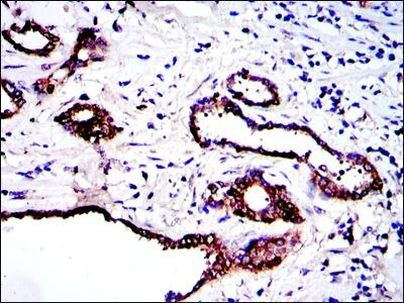 PKN2 Antibody in Immunohistochemistry (Paraffin) (IHC (P))