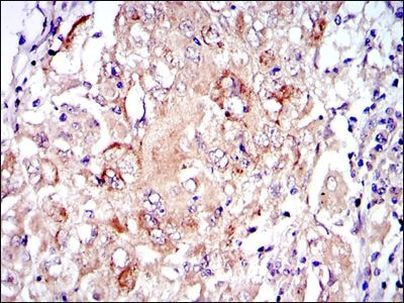 PKN2 Antibody in Immunohistochemistry (Paraffin) (IHC (P))