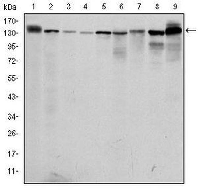 PKN2 Antibody in Western Blot (WB)