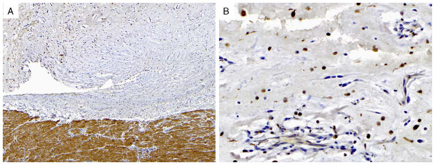 PRKAR1A Antibody in Immunohistochemistry (Paraffin) (IHC (P))