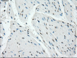 PRKAR1A Antibody in Immunohistochemistry (Paraffin) (IHC (P))