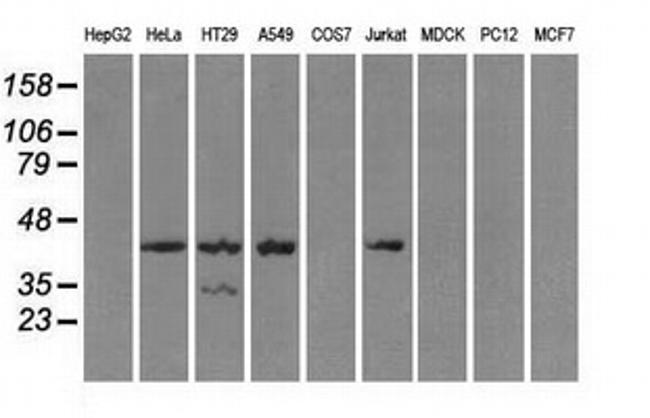 PRKAR1A Antibody in Western Blot (WB)