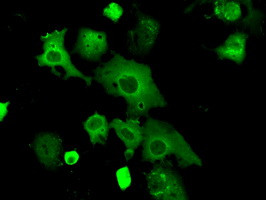 PRKAR2A Antibody in Immunocytochemistry (ICC/IF)