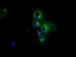 PRKAR2A Antibody in Immunocytochemistry (ICC/IF)