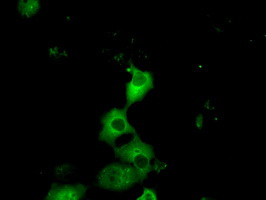 PRKAR2A Antibody in Immunocytochemistry (ICC/IF)