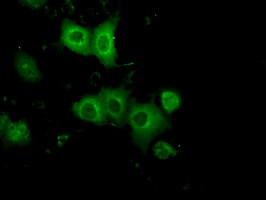 PRKAR2A Antibody in Immunocytochemistry (ICC/IF)