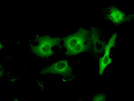 PRKAR2A Antibody in Immunocytochemistry (ICC/IF)