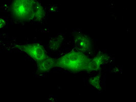 PRKAR2A Antibody in Immunocytochemistry (ICC/IF)