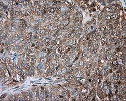 PRKAR2A Antibody in Immunohistochemistry (Paraffin) (IHC (P))