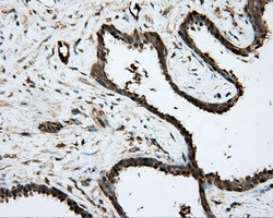 PRKAR2A Antibody in Immunohistochemistry (Paraffin) (IHC (P))