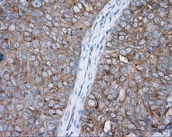 PRKAR2A Antibody in Immunohistochemistry (Paraffin) (IHC (P))