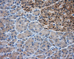 PRKAR2A Antibody in Immunohistochemistry (Paraffin) (IHC (P))