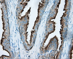 PRKAR2A Antibody in Immunohistochemistry (Paraffin) (IHC (P))