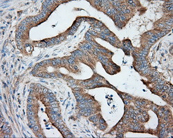 PRKAR2A Antibody in Immunohistochemistry (Paraffin) (IHC (P))